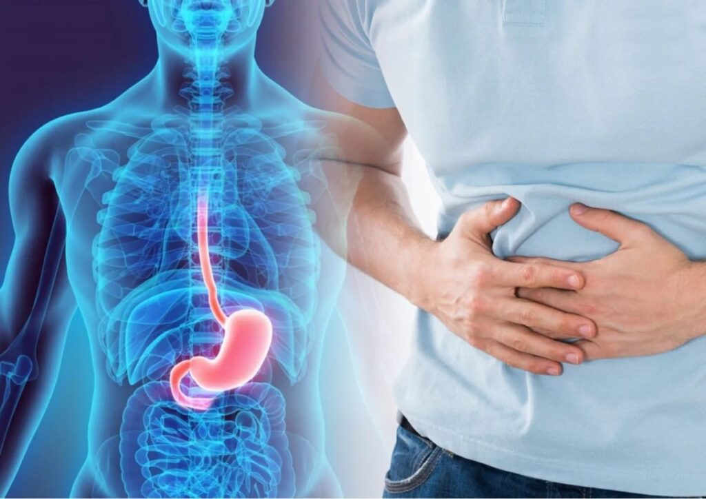 Homem com dor de estômago segurando o abdômen, ao lado de imagem ilustrativa do sistema digestivo com o estômago em destaque, representando sintomas como gastrite e dor de estômago