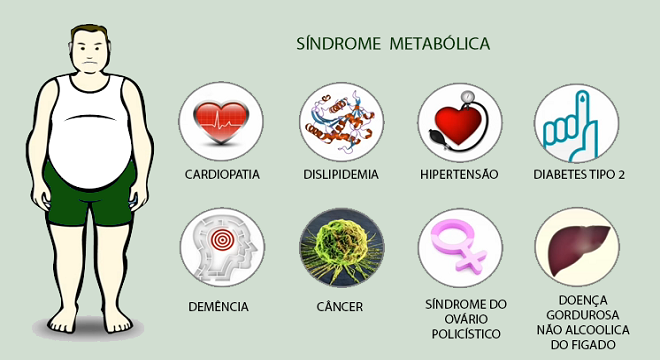 Infográfico sobre a Síndrome Metabólica. A imagem mostra uma figura humana com excesso de peso, com ícones representando várias condições associadas à síndrome. Os ícones incluem: um coração representando cardiopatia, um gráfico de colesterol para dislipidemia, um coração com um estetoscópio para hipertensão, um dedo apontando para diabetes tipo 2, um cérebro para demência, uma planta para câncer, o símbolo feminino para síndrome do ovário policístico e um fígado com gordura para doença gordurosa não alcoólica do fígado. O título "Síndrome Metabólica" está no topo da imagem.