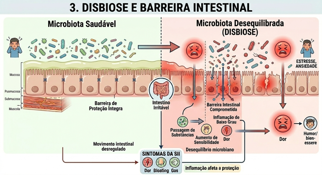 Imagem ilustrativa comparando microbiota saudável e microbiota desequilibrada (disbiose). À esquerda, mostra um intestino com barreira de proteção íntegra e bactérias equilibradas acima da mucosa intestinal. À direita, apresenta microbiota desregulada com inflamação de baixo grau, aumento da sensibilidade, passagem de substâncias pela barreira intestinal comprometida e sintomas como dor, gases e distensão. Também destaca influência de estresse e ansiedade no agravamento dos sintomas.